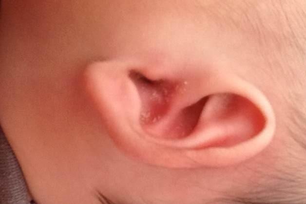 油耳 搜狗百科 油耳 搜狗百科