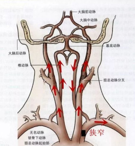 椎动脉分段示意图图片