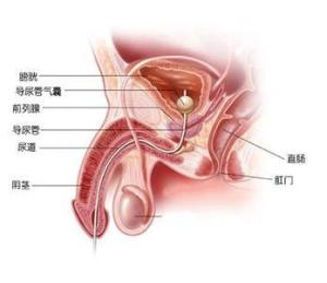 陰囊上有白色小疙瘩