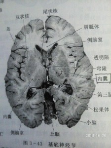 内囊模式图图片