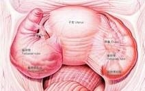 输卵管积水 输卵管积水