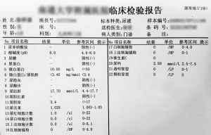 怎么测尿酸碱度 300