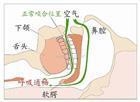 打鼾（图）