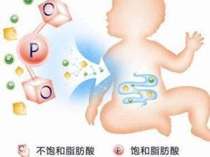OPO结构脂