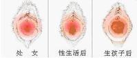 处女膜渐变图