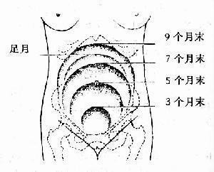 妊娠