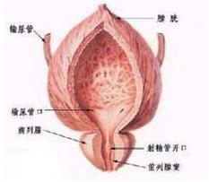 急性盆腔炎