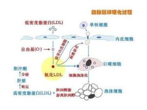 低密度脂蛋白-胆固醇