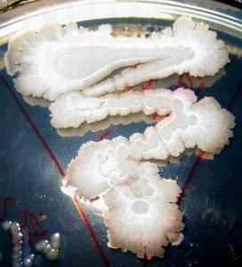 八叠球菌显微镜图片