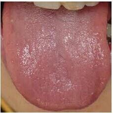红绛舌