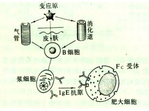 Ⅰ型变态反应