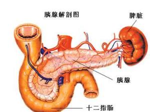 胰腺炎