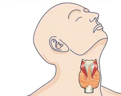 图册——亚急性甲状腺炎