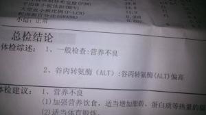 ALT（谷丙转氨酶）