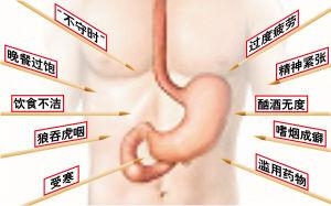 急性胃肠炎