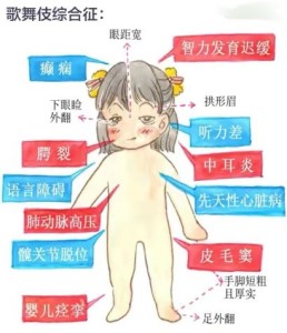 歌舞伎化妆综合症