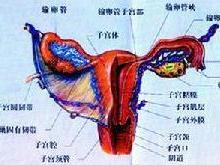 附件炎