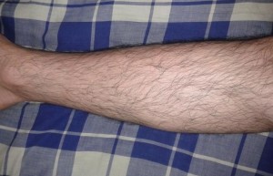 腿毛 人类大腿与小腿上生长的毛发 搜狗百科 腿毛 人类大腿与小腿上生长的毛发 搜狗百科