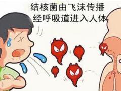 结核病