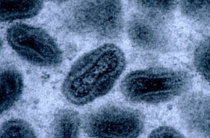 天花病毒 - 搜狗百科