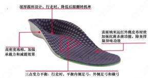 大脚趾外翻是什么样子 300
