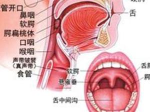 扁桃体发炎