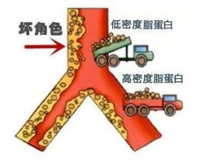 低密度脂蛋白-胆固醇