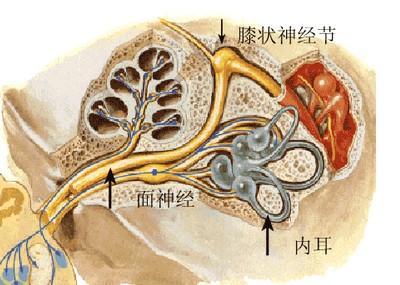 神經炎