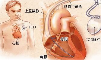 窦性心律