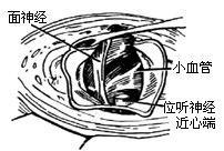 听神经
