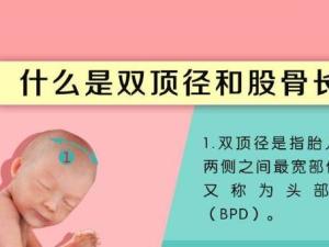 双顶径