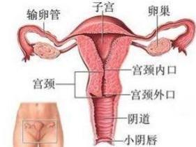 宫颈柱状上皮异位