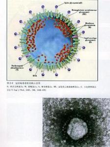 重症急性呼吸综合征