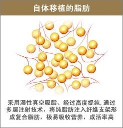 自体移植的脂肪