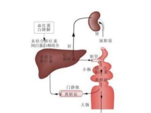 间接胆红素