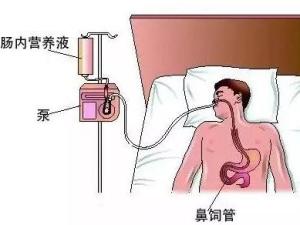 胰腺炎