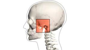 颞下颌关节紊乱综合征