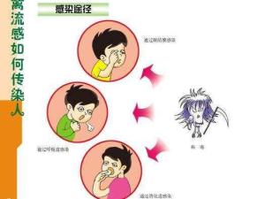 人感染禽流感