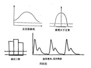 滑脉