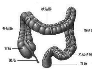 盲肠炎是怎么引起的图片