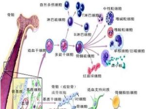 骨髓移植