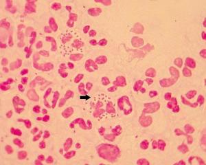 脑膜炎球菌(meningococcus)的学名是脑膜炎奈瑟氏球菌(n.