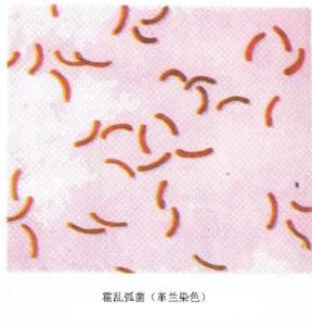 霍乱弧菌显微镜下图片图片