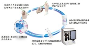 TCT检查流程图
