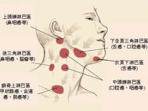 脸上淋巴结分布图图片