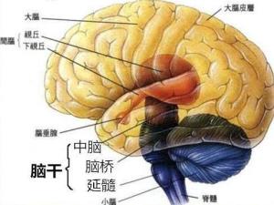 编辑1基本简介brainstem hemorrhage英文名称脑干出血中