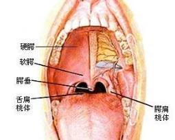 扁桃腺 - 搜狗百科