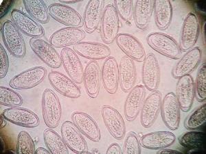 肛门外虫卵检查法有:编辑1虫卵的检查法3词条图册2透明胶纸粘拭漂浮法