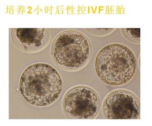 培养2h后性控ivf胚胎