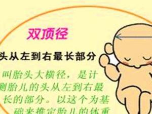 双顶径